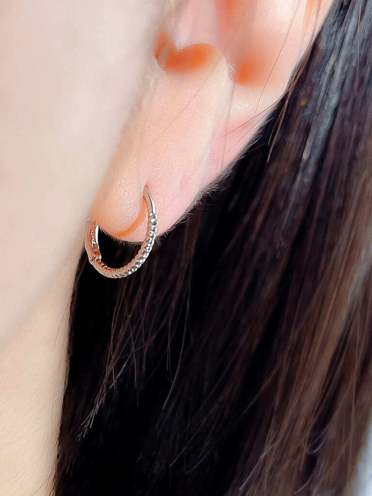 Simple ring